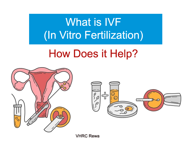 IVF (In Vitro Fertilization)